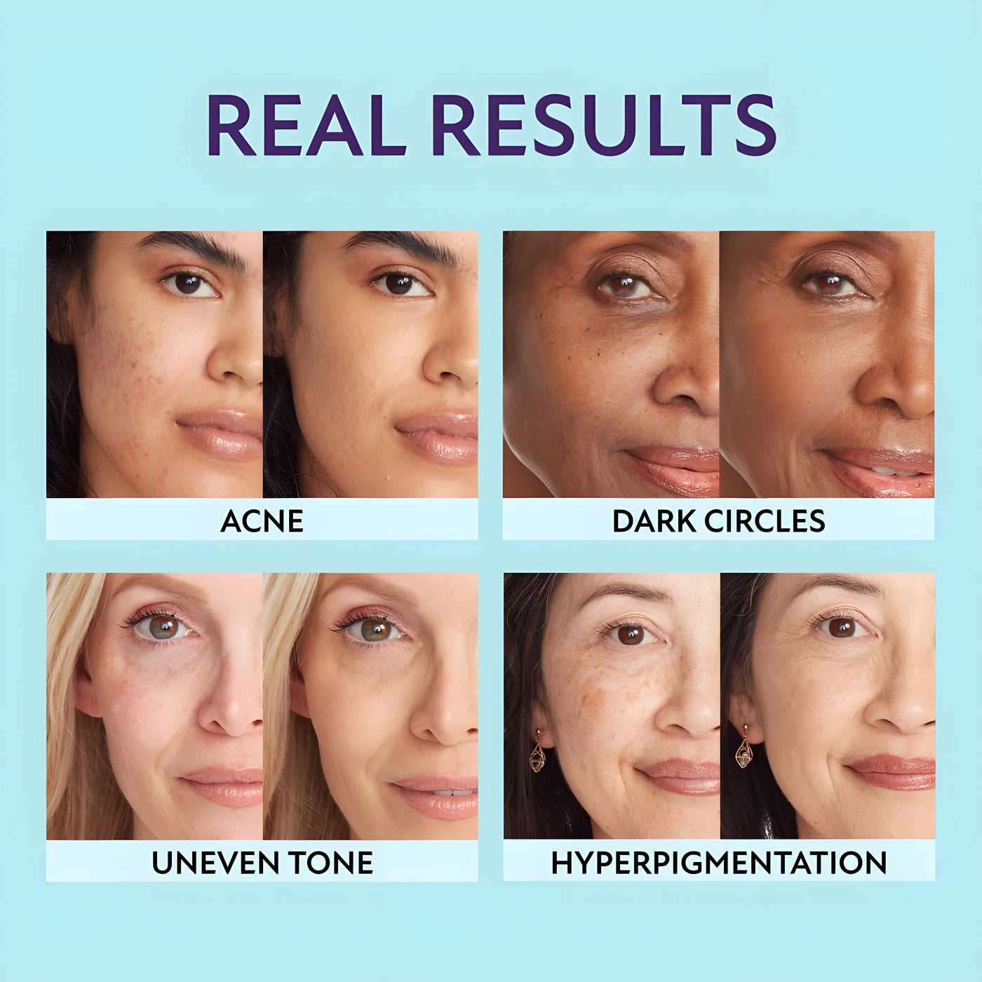 RadianceGlow™ – ihosi, mutta parempana + ilmainen harja