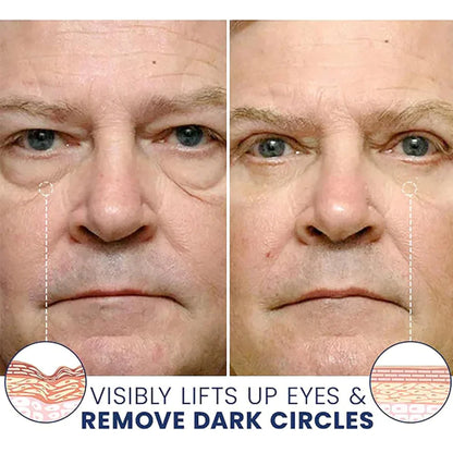 Herää Lift™