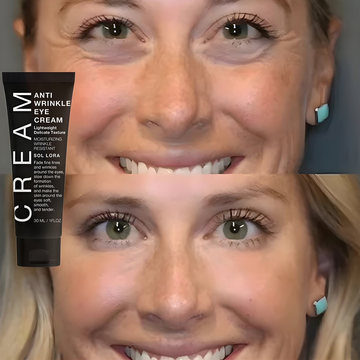 Instant Silmänympärys Lift™ | 1+1 ILMAISEKSI