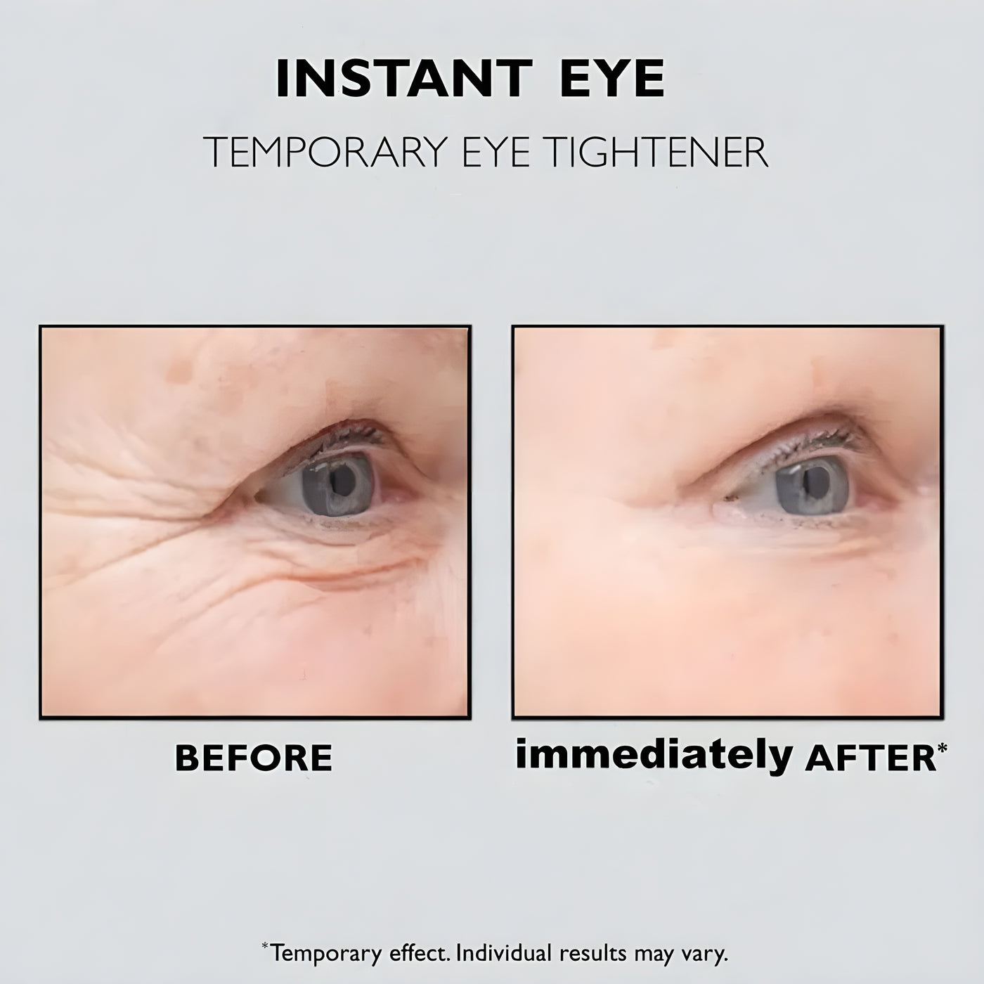 Instant Silmänympärys Lift™ | 1+1 ILMAISEKSI