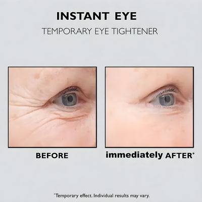 Instant Silmänympärys Lift™ | 1+1 ILMAISEKSI