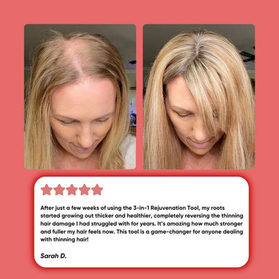 HairGlow™ 2.0 | Nyt entistä tehokkaampi!