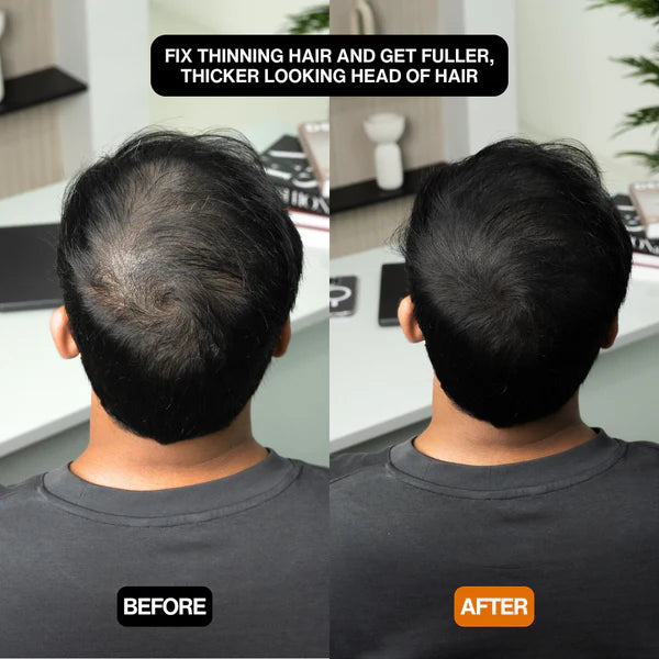 FlawlessLocks™ | Täydellinen hiustyyli hetkessä!| 1+1 ILMAISEKSI!