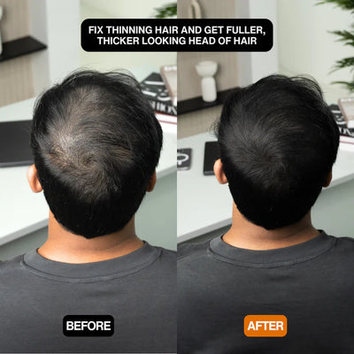 FlawlessLocks™ | Täydellinen hiustyyli hetkessä!| 1+1 ILMAISEKSI!
